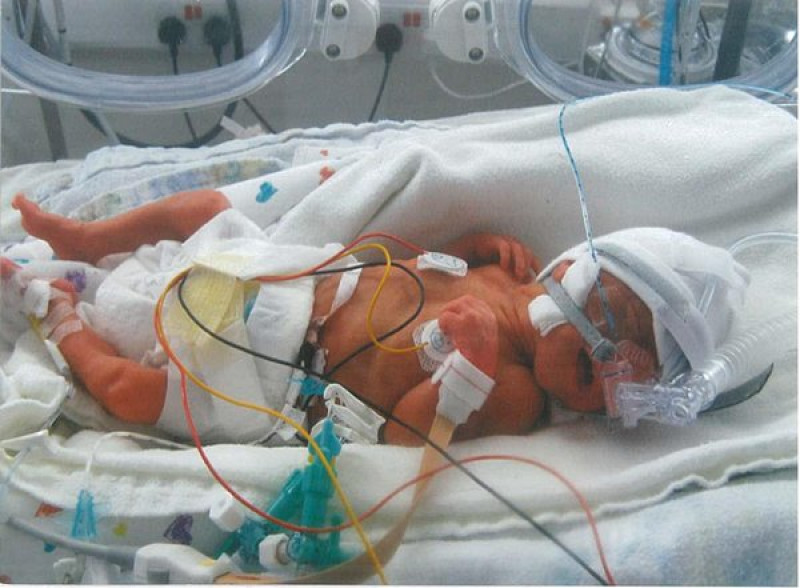 Main image for 'Premature baby died due to inaction by medical staff'