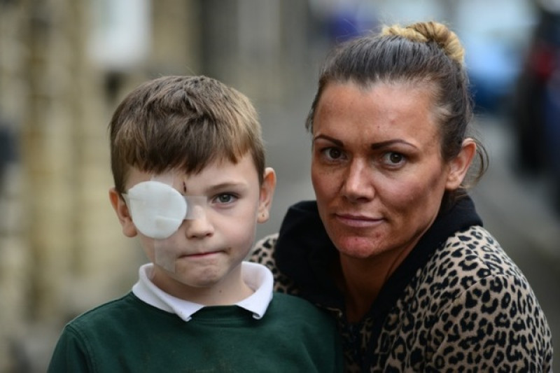 Main image for Boy left with eye glued shut for almost a week after treatment